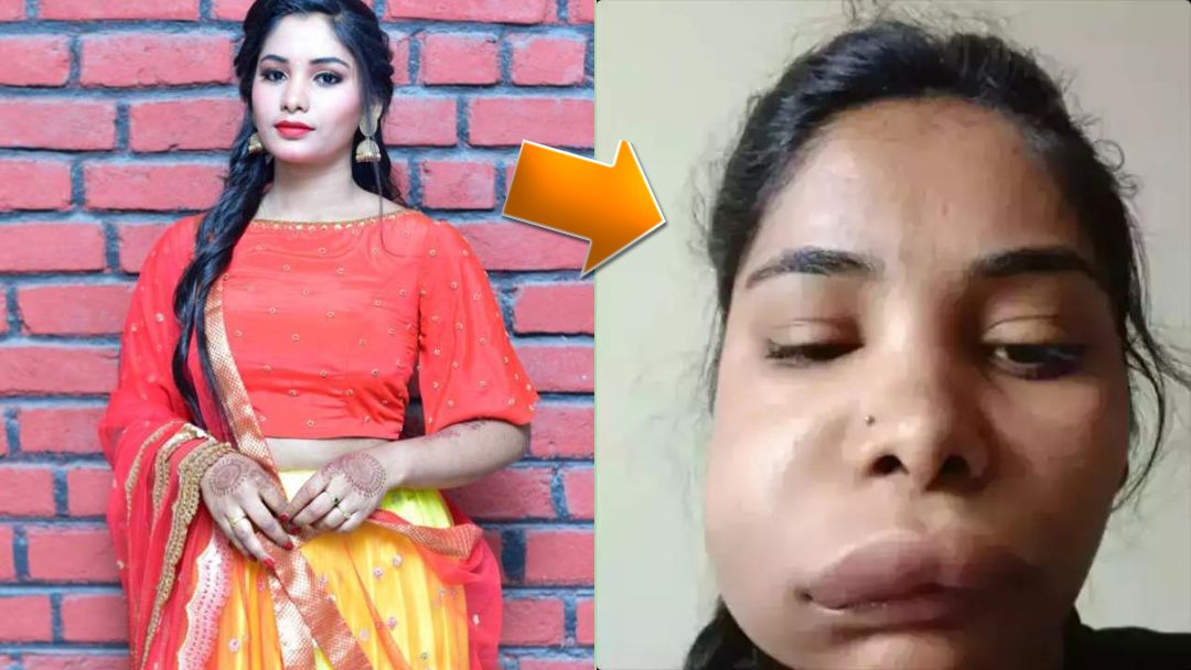 actress swati satish surgery