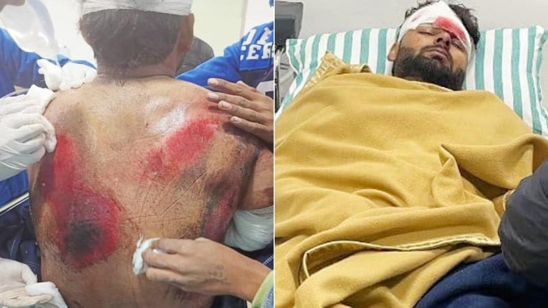 Rishabh Pant Health Update