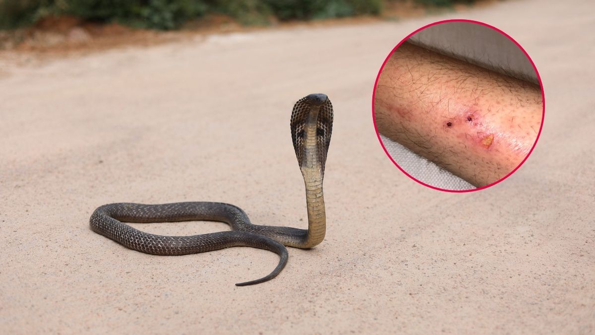 Snake Biting Guidelines